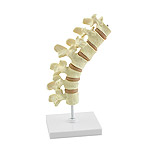 Vertebral Column Osteoporosis Model